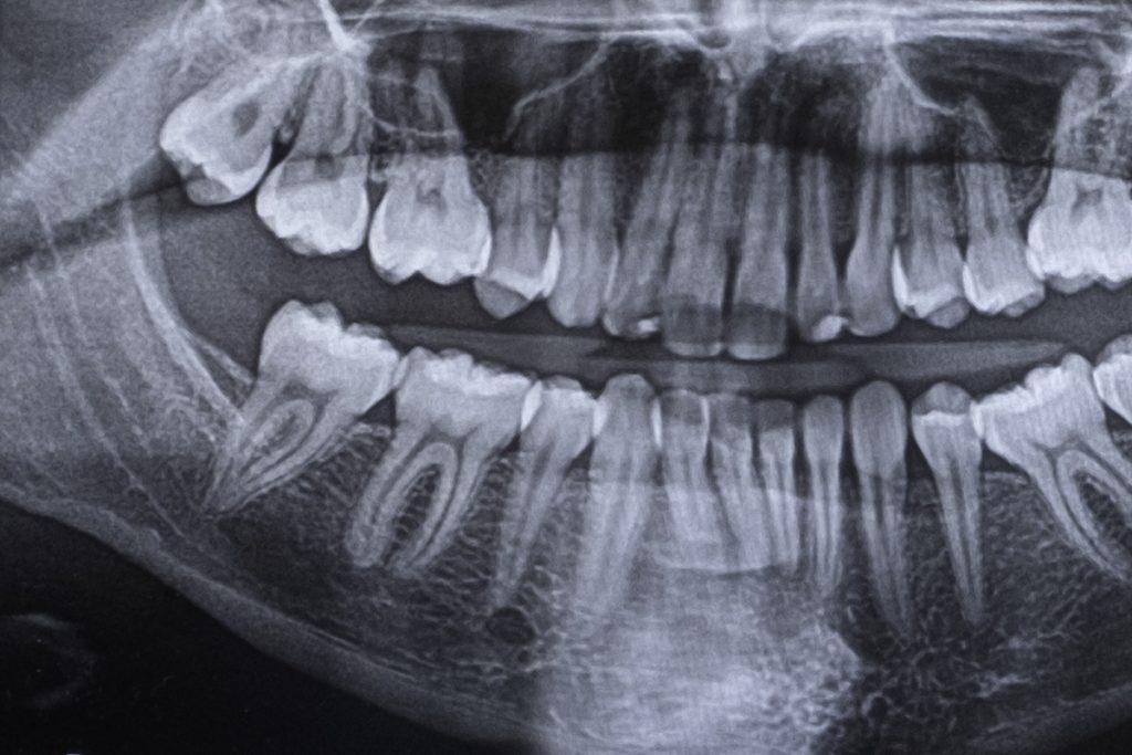 Bank House | Root Canal